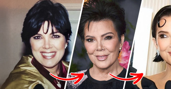 Kris Jenner Quietly Got a Facelift—Now Everyone’s Calling It the Best in Hollywood