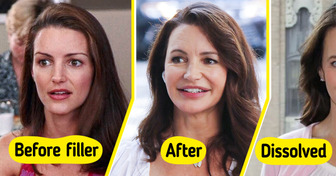 8 Celebrities Who Trusted Cosmetic Surgery — and It Went Terribly Wrong
