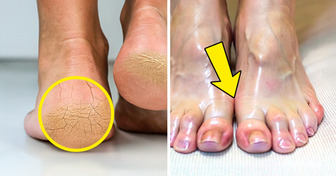 7 Beauty Tips for Feet You Might Not Have Tried