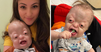 A Mom Shares Pics of Her Unique Son Online, and Pleas for Her to Stop Pour In