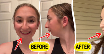 “SO CUTE!” People Are in Awe After This Woman’s Multi-Hour Jaw Transformation