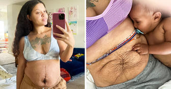 A Woman Shares Her HONEST Depiction of Postpartum Bodies