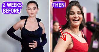 “Are They Part of Her Breasts?” Selena Gomez Stunned in Red Dress, But People Can’t Stop Questioning about One Detail