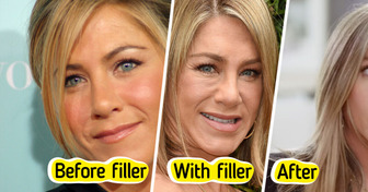 “I’m Not Even Going to Try Anymore,” Jennifer Aniston Revealed Truth About Botox, Fillers, and Ageing