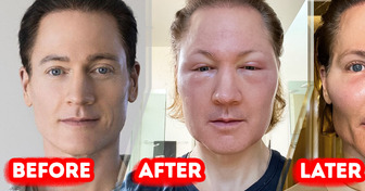 Anti-Aging Guru Bryan Johnson Reveals How His Attempt to Reverse Aging Went Horribly Wrong