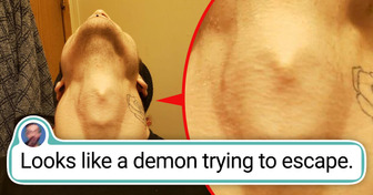 16 People With Unique Body Features You Don’t See Every Day