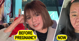 28-Year-Old Woman Shares Shocking Pregnancy Face Transformation With Full Honesty