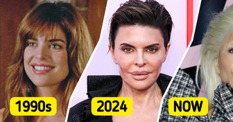 “Her Lips Are Bigger Than Ever”, Lisa Rinna’s Latest Appearance Sparks Controversy