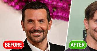 “What Happened to Him?” Bradley Cooper, 50, Debuts a Striking New Look — Plastic Surgery Rumors Swirl