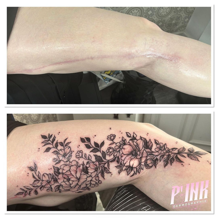 Scar coverup tattoo  rTattooDesigns