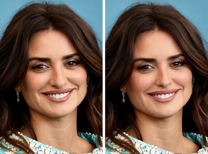14 Beautiful Stars Who Would Look Totally Different With Another Nose Shape